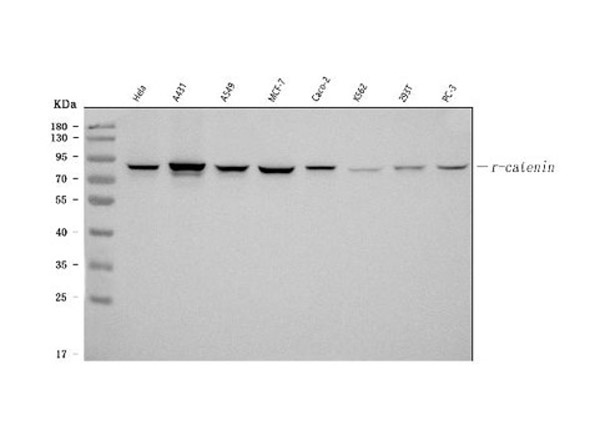 Western blot analysis of Catenin gamma (Plakoglobin)